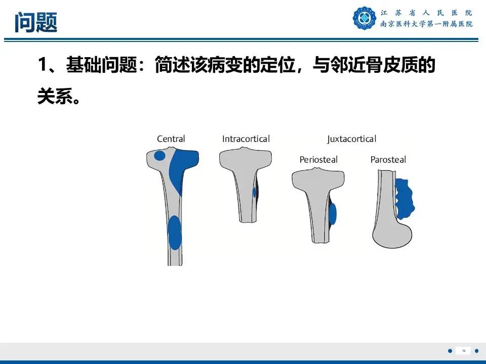 影像PPT - 【PPT】奇异性骨旁骨软骨瘤样增生-11