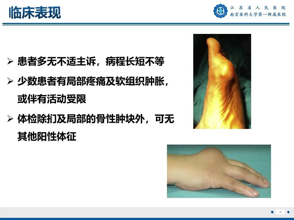 影像PPT - 【PPT】奇异性骨旁骨软骨瘤样增生-28
