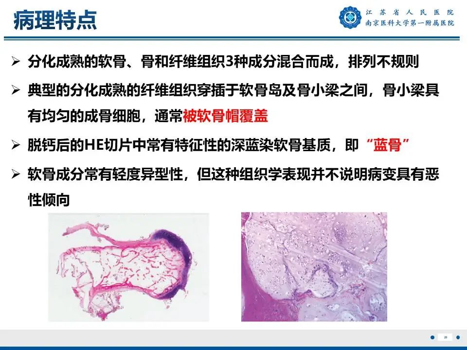 影像PPT - 【PPT】奇异性骨旁骨软骨瘤样增生-29