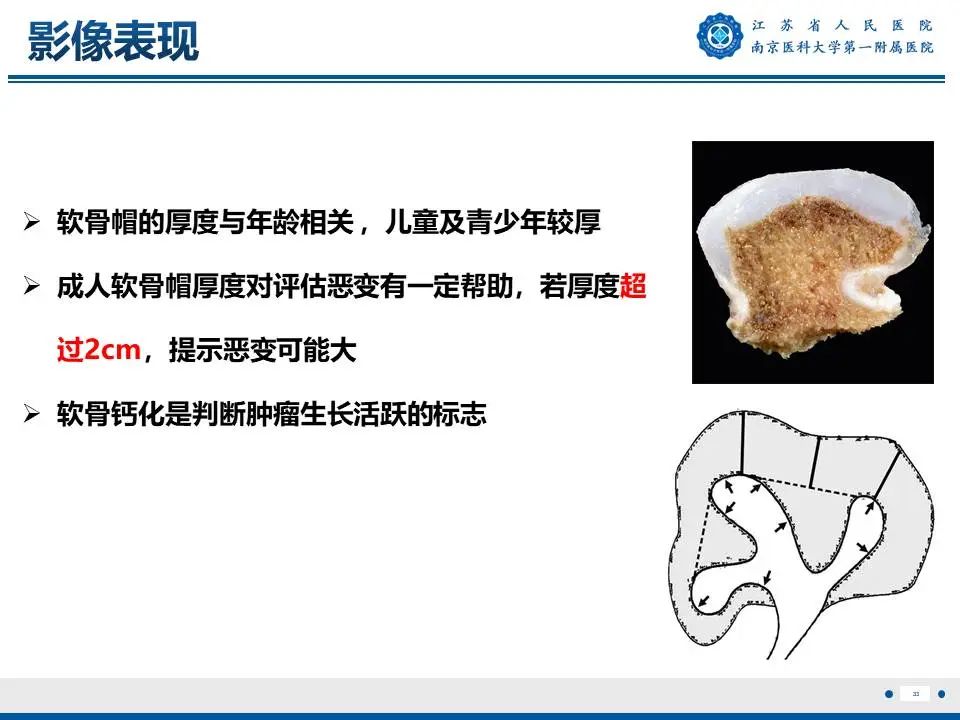 影像PPT - 【PPT】奇异性骨旁骨软骨瘤样增生-34