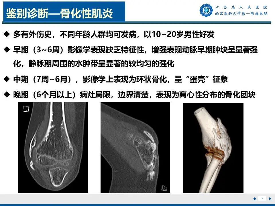 影像PPT - 【PPT】奇异性骨旁骨软骨瘤样增生-39
