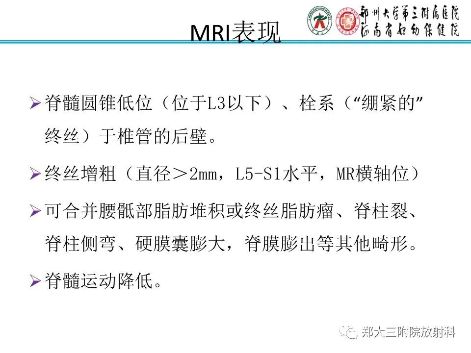 影像PPT - 【PPT】脊髓栓系综合征-15