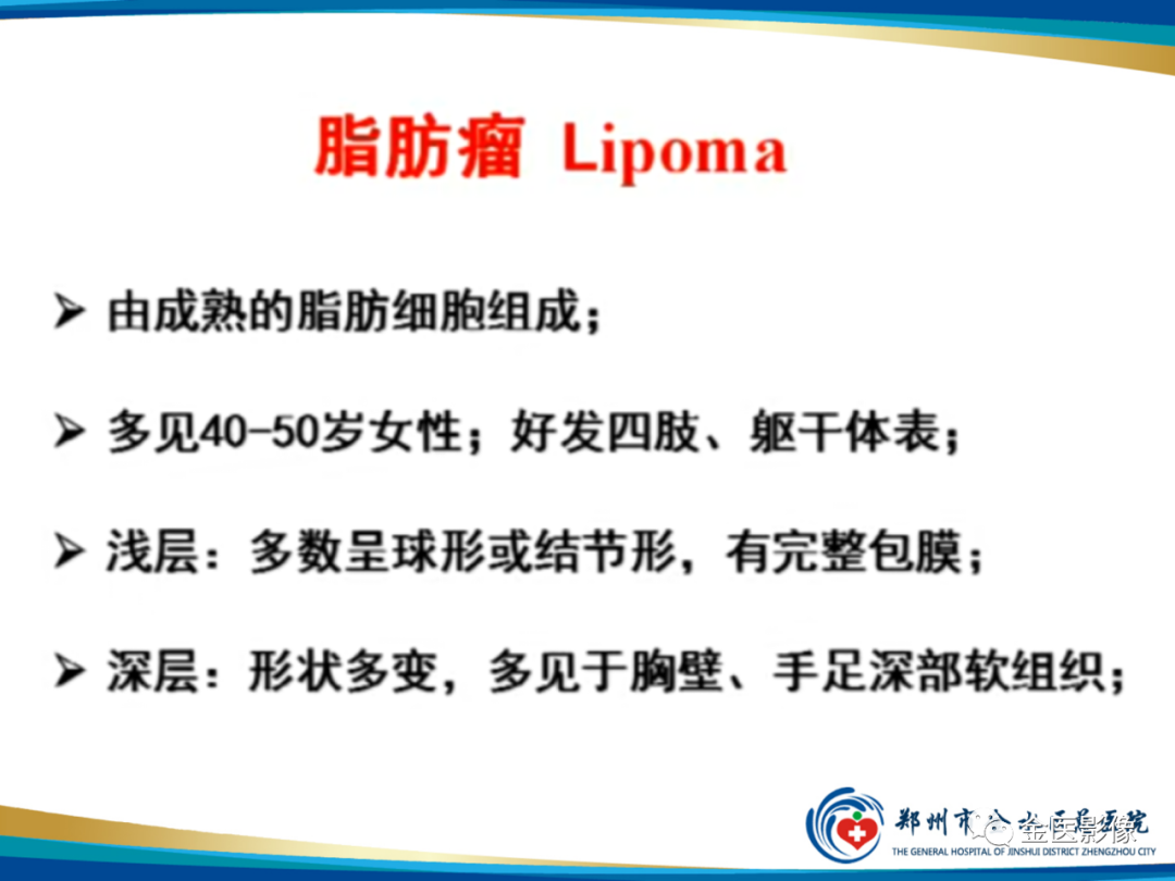 影像PPT - 【PPT】软组织肿瘤影像表现与诊断思路-7