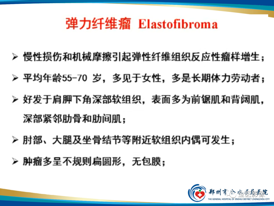 影像PPT - 【PPT】软组织肿瘤影像表现与诊断思路-21