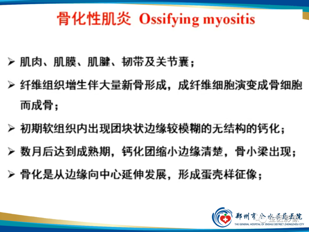 影像PPT - 【PPT】软组织肿瘤影像表现与诊断思路-23