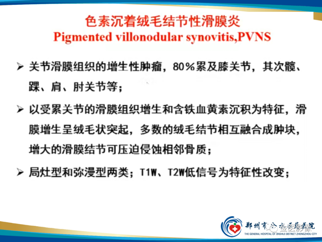 影像PPT - 【PPT】软组织肿瘤影像表现与诊断思路-42