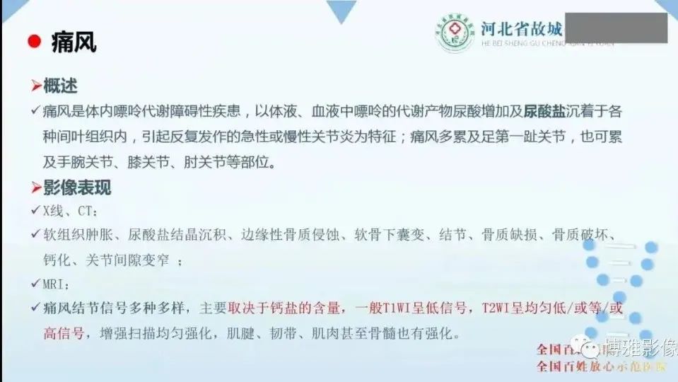 影像PPT - 【PPT】论T2低信号几种腱鞘滑膜疾病-3