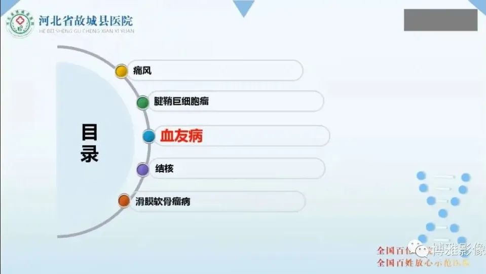 影像PPT - 【PPT】论T2低信号几种腱鞘滑膜疾病-15