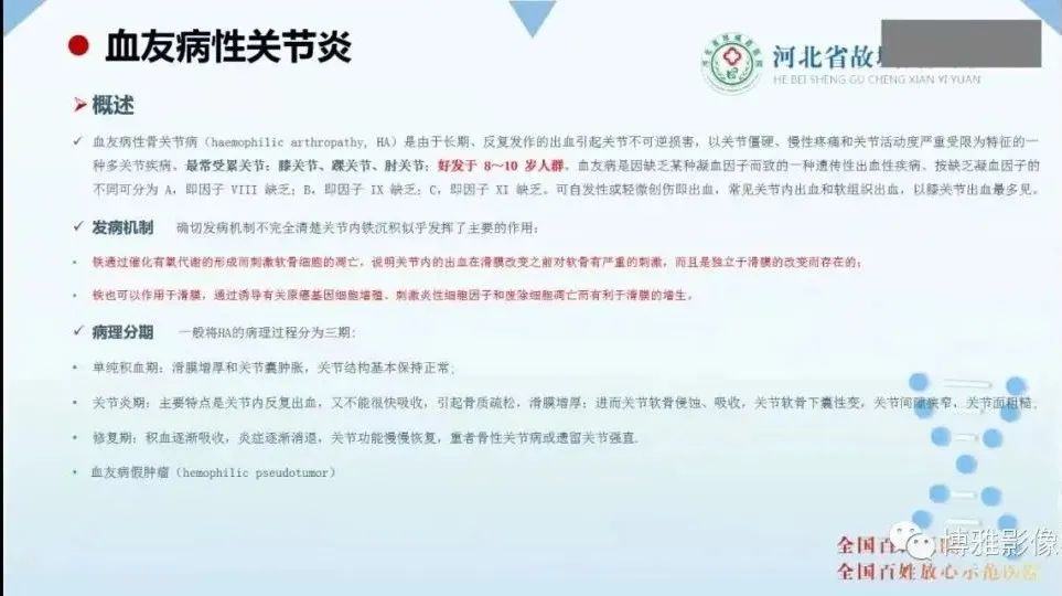 影像PPT - 【PPT】论T2低信号几种腱鞘滑膜疾病-16