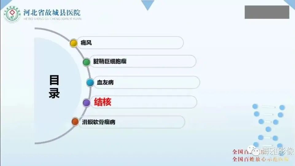 影像PPT - 【PPT】论T2低信号几种腱鞘滑膜疾病-23