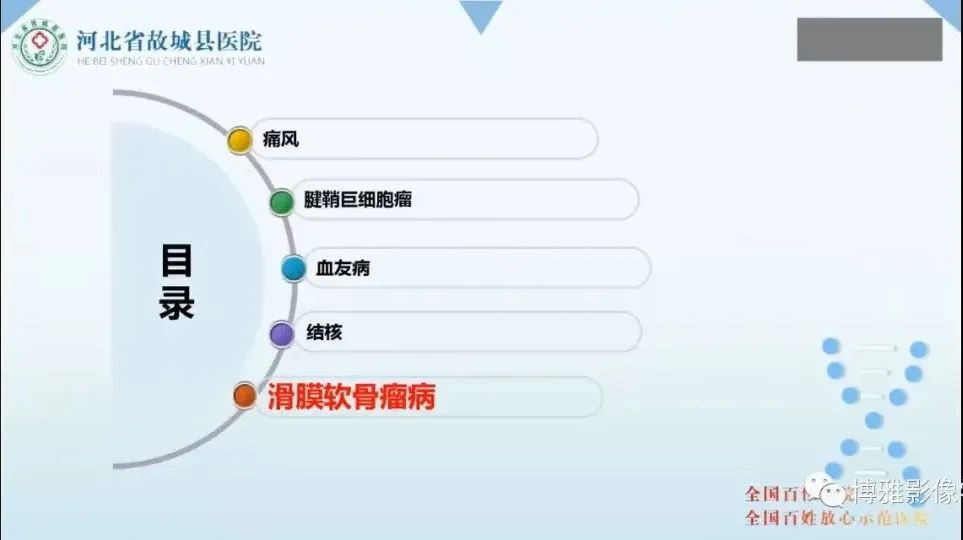 影像PPT - 【PPT】论T2低信号几种腱鞘滑膜疾病-31