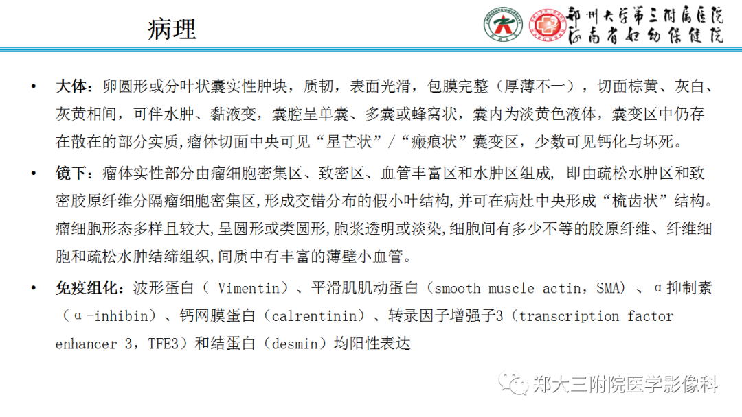 影像PPT - 【PPT】呈“湖岛征”影像表现的卵巢硬化性间质瘤-4