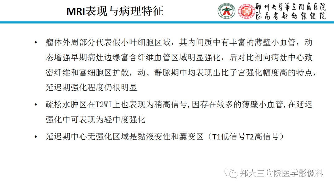影像PPT - 【PPT】呈“湖岛征”影像表现的卵巢硬化性间质瘤-11