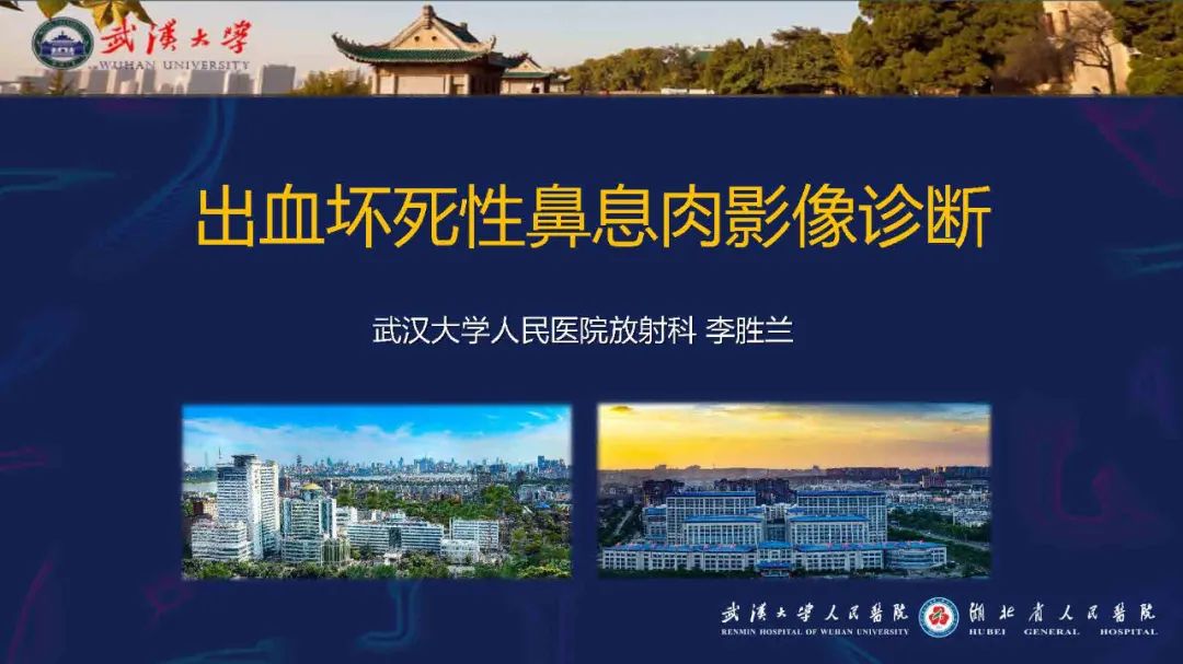 影像PPT - 【PPT】出血坏死性鼻息肉影像诊断-1