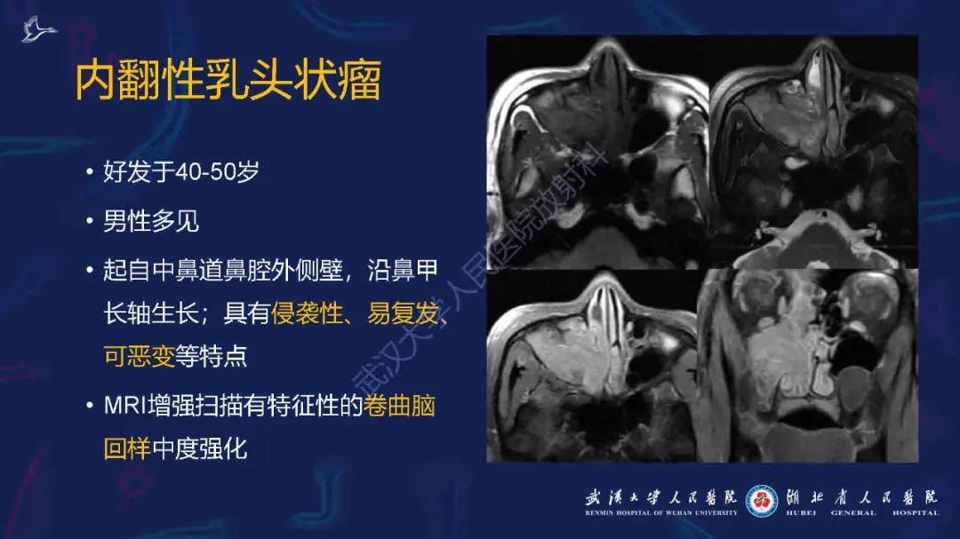 影像PPT - 【PPT】出血坏死性鼻息肉影像诊断-19
