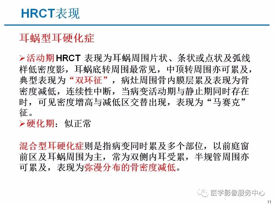 影像PPT - 耳硬化症中的“双环征”-9 影像PPT - 耳硬化症中的“双环征”-9