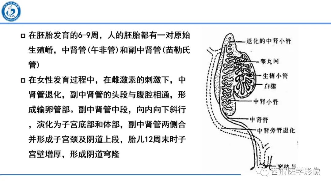 影像PPT - 【病例】多囊卵巢综合征1例MR影像诊断与鉴别-9