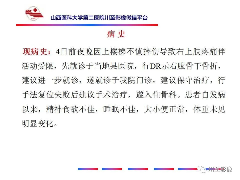 影像PPT - 【PPT】石骨症-3 影像PPT - 【PPT】石骨症-3