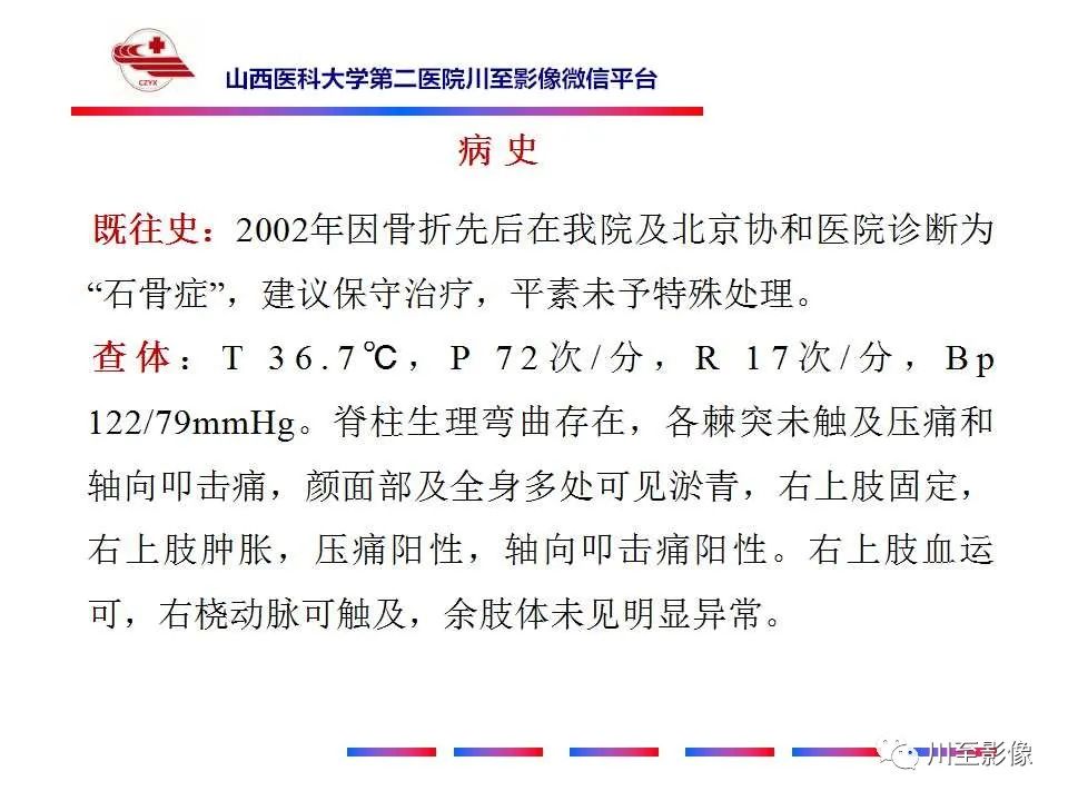 影像PPT - 【PPT】石骨症-4 影像PPT - 【PPT】石骨症-4
