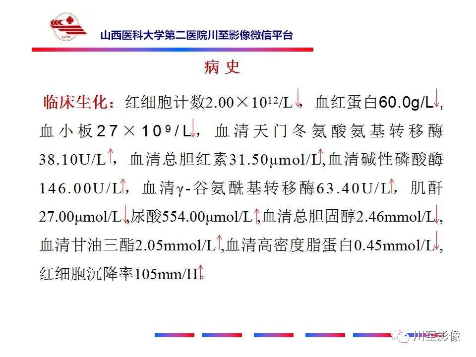影像PPT - 【PPT】石骨症-5 影像PPT - 【PPT】石骨症-5
