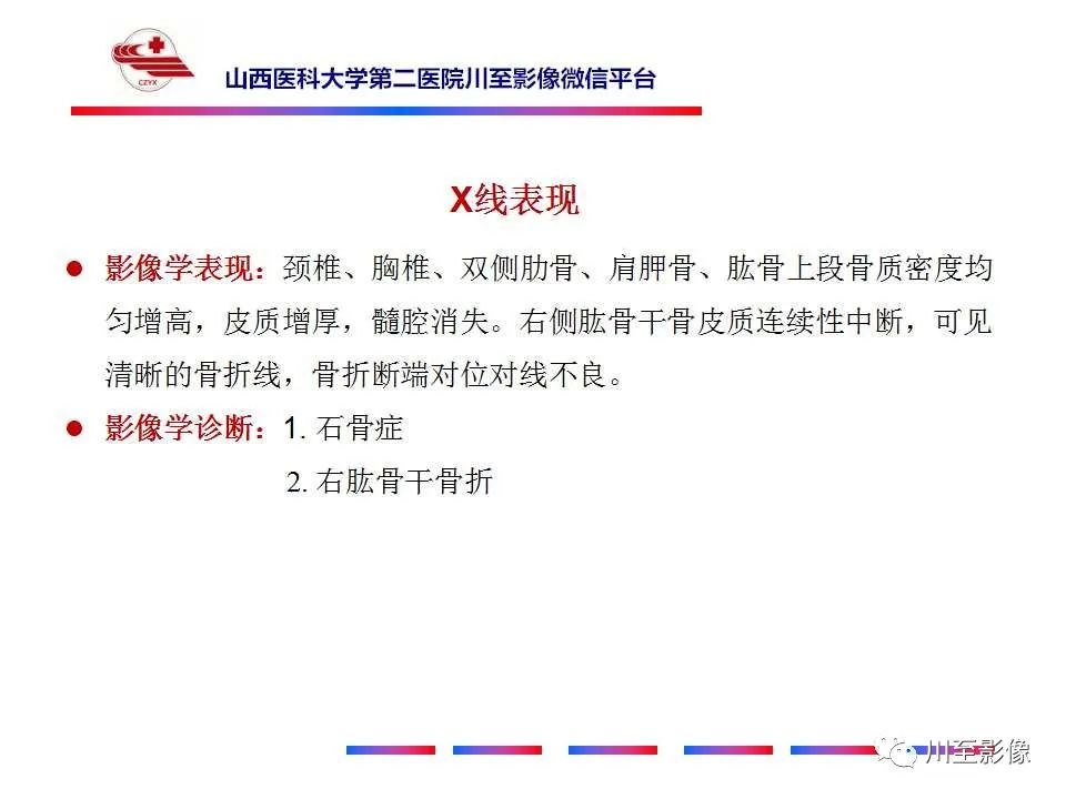 影像PPT - 【PPT】石骨症-8 影像PPT - 【PPT】石骨症-8