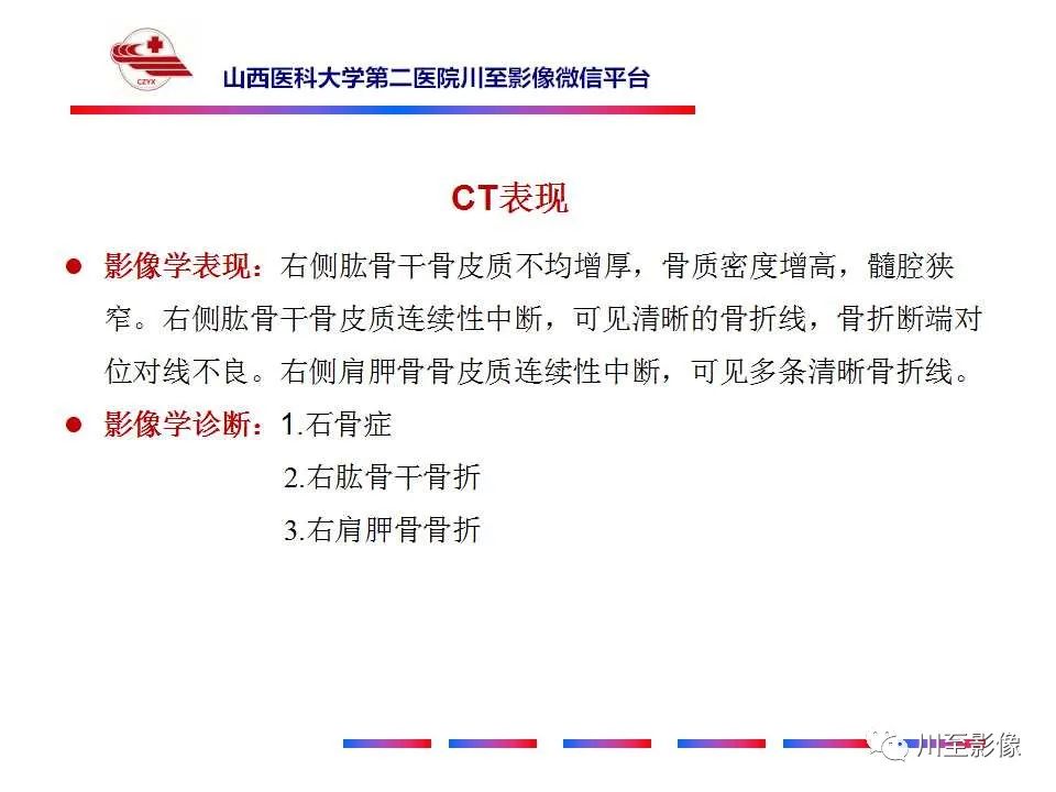 影像PPT - 【PPT】石骨症-12 影像PPT - 【PPT】石骨症-12