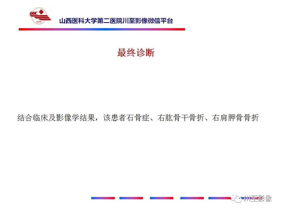 影像PPT - 【PPT】石骨症-13 影像PPT - 【PPT】石骨症-13