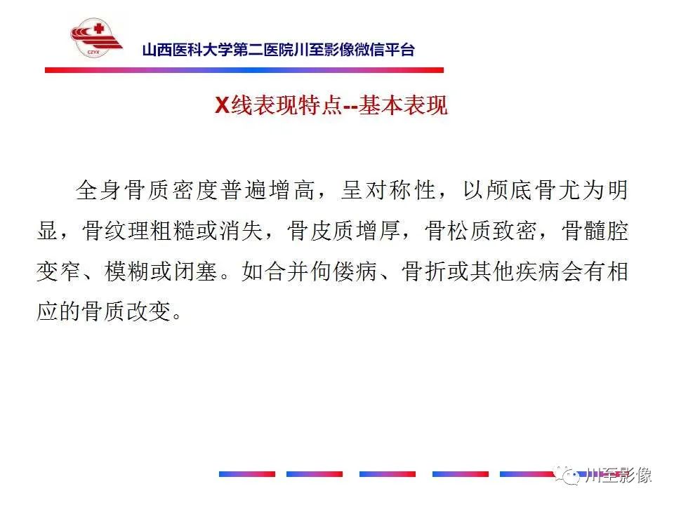 影像PPT - 【PPT】石骨症-18 影像PPT - 【PPT】石骨症-18
