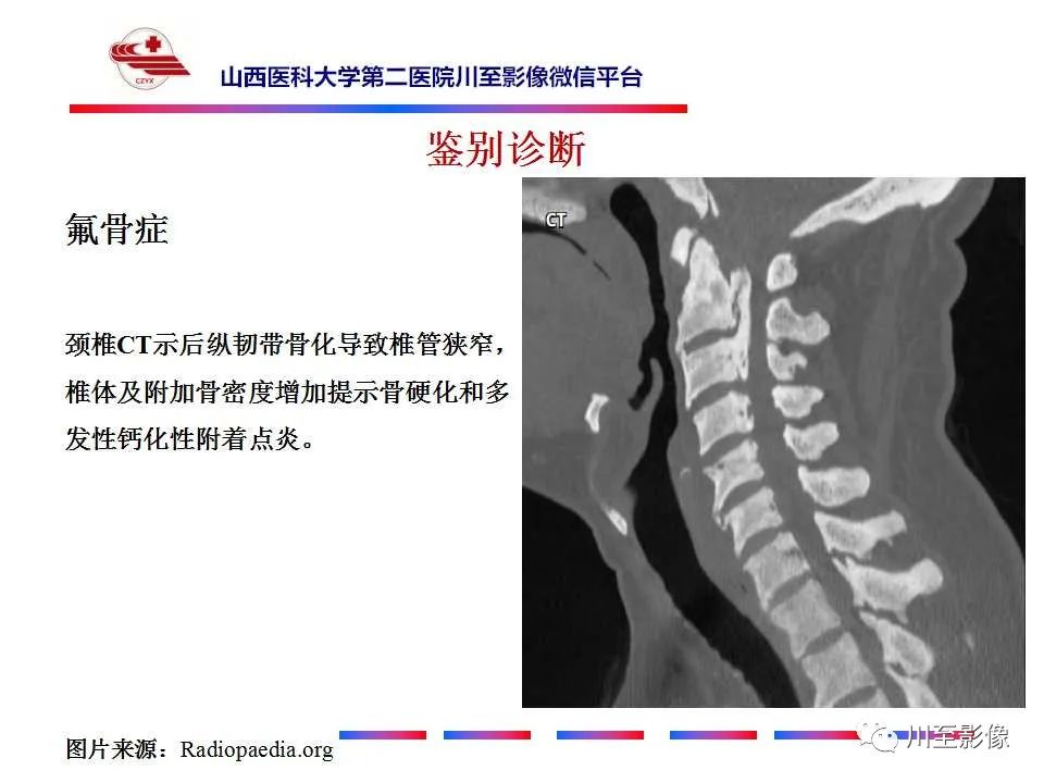影像PPT - 【PPT】石骨症-27 影像PPT - 【PPT】石骨症-27