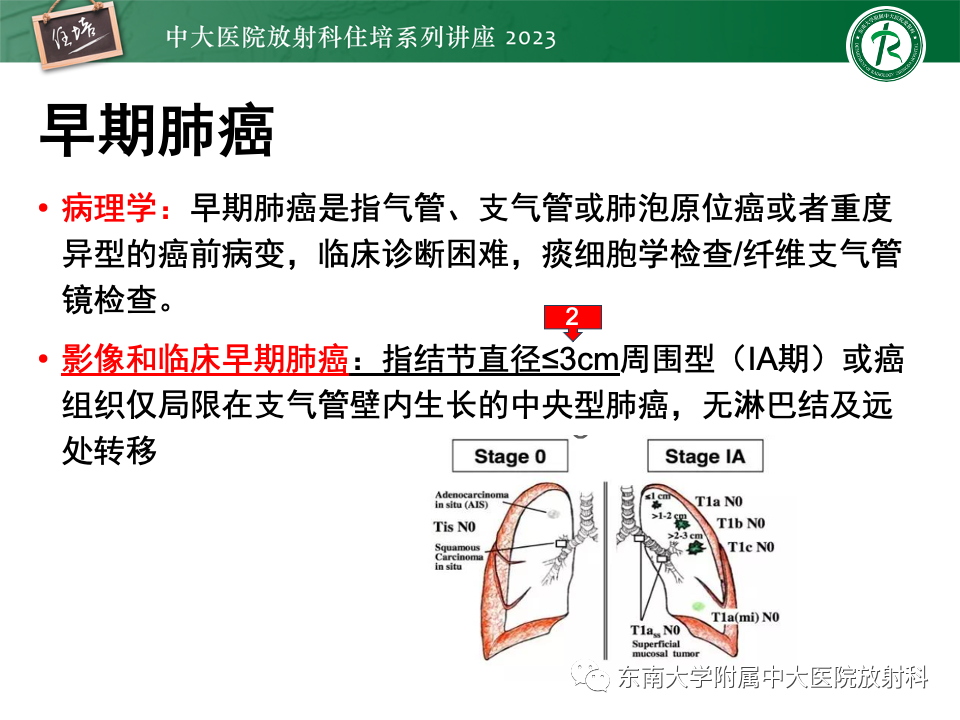 影像PPT - 【PPT】肺癌影像征象及病理分析-7