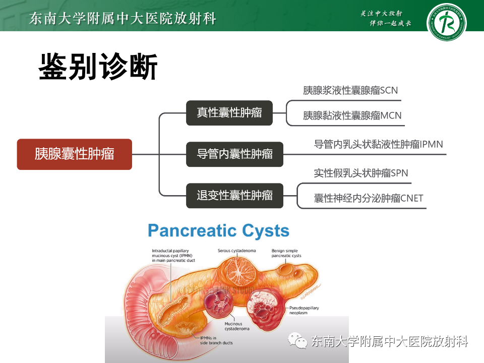 影像PPT - 【PPT】胰腺实性假乳头状瘤-19 影像PPT - 【PPT】胰腺实性假乳头状瘤-19