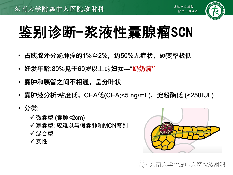影像PPT - 【PPT】胰腺实性假乳头状瘤-20 影像PPT - 【PPT】胰腺实性假乳头状瘤-20
