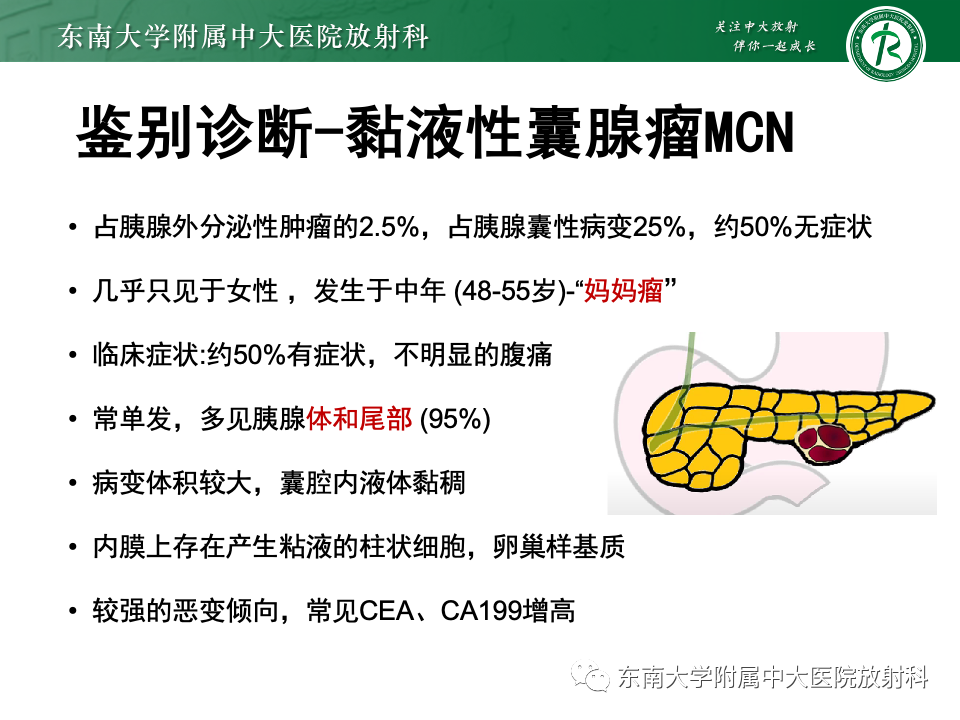 影像PPT - 【PPT】胰腺实性假乳头状瘤-24 影像PPT - 【PPT】胰腺实性假乳头状瘤-24