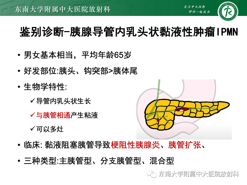 影像PPT - 【PPT】胰腺实性假乳头状瘤-28 影像PPT - 【PPT】胰腺实性假乳头状瘤-28