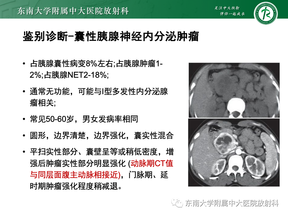 影像PPT - 【PPT】胰腺实性假乳头状瘤-33 影像PPT - 【PPT】胰腺实性假乳头状瘤-33
