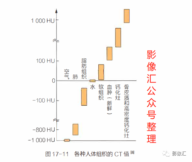 影像PPT - 妇科急腹症影像要点:定位、卵巢出血、卵巢肿块蒂扭转、异位妊娠及囊肿破裂-10 影像PPT - 妇科急腹症影像要点:定位、卵巢出血、卵巢肿块蒂扭转、异位妊娠及囊肿破裂-10