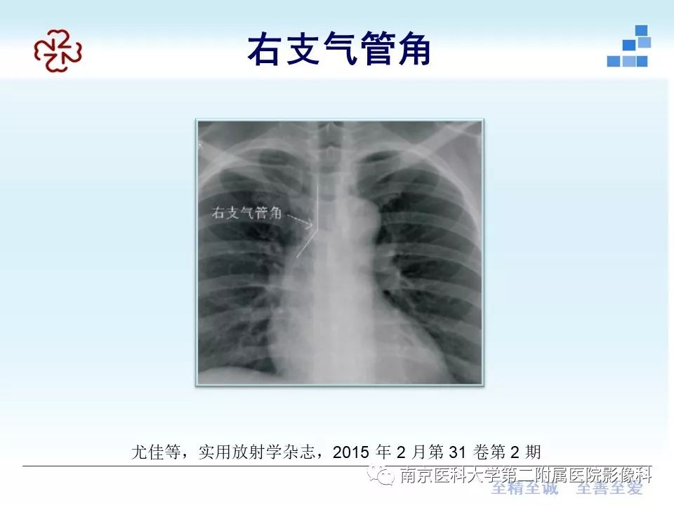 影像PPT - 【PPT】PICC管尖端胸片定位-14