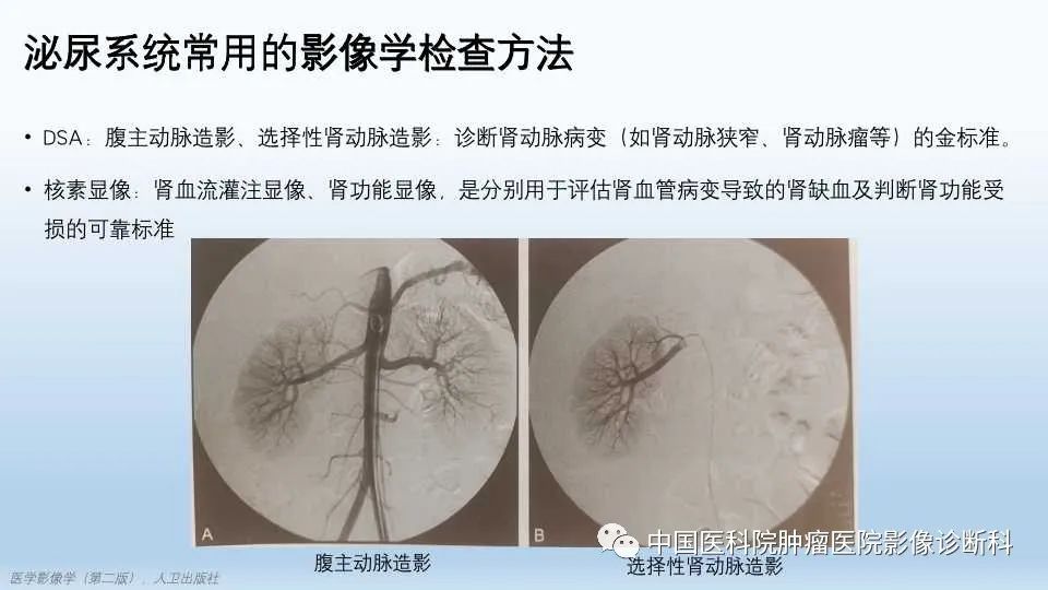 影像PPT - 【PPT】肾囊肿-6