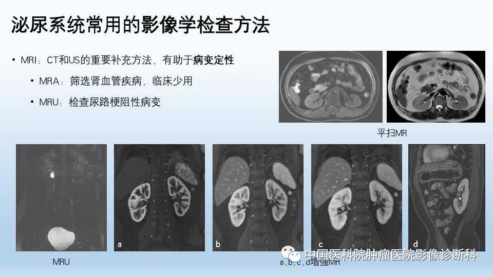 影像PPT - 【PPT】肾囊肿-9