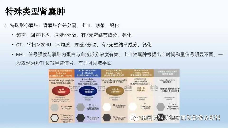 影像PPT - 【PPT】肾囊肿-16
