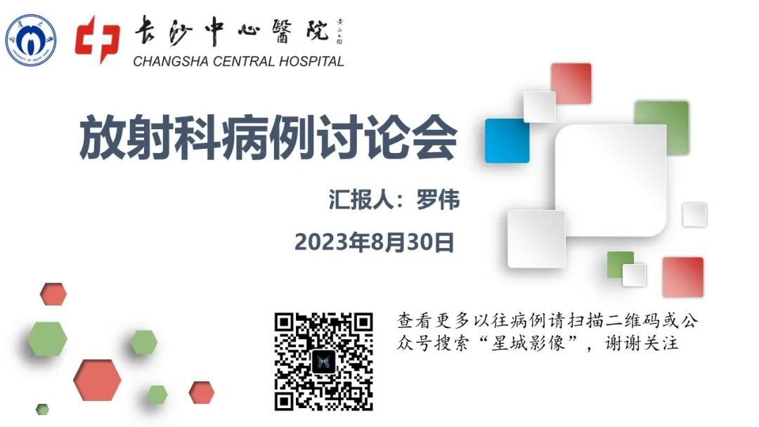 影像PPT - 【病例】腮腺肌上皮瘤1例MR影像-1 影像PPT - 【病例】腮腺肌上皮瘤1例MR影像-1