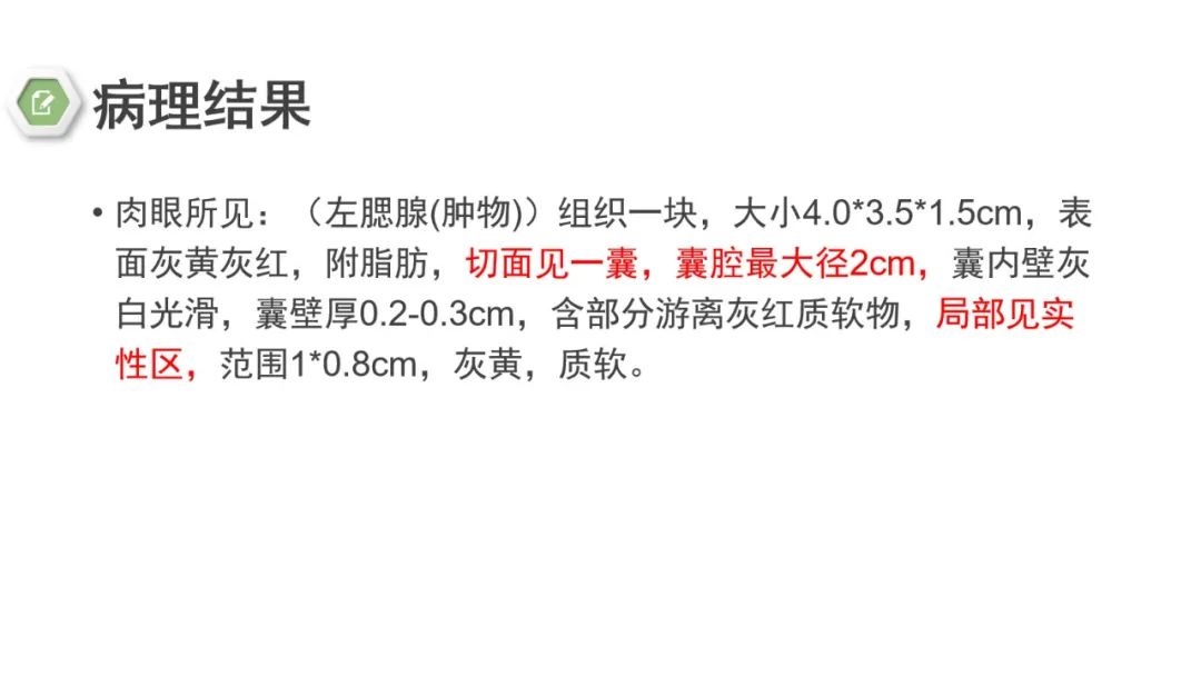 影像PPT - 【病例】腮腺肌上皮瘤1例MR影像-12 影像PPT - 【病例】腮腺肌上皮瘤1例MR影像-12