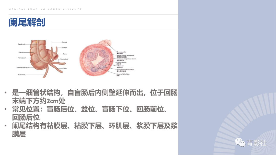 影像PPT - 【PPT】阑尾粘液性肿瘤的诊断-3