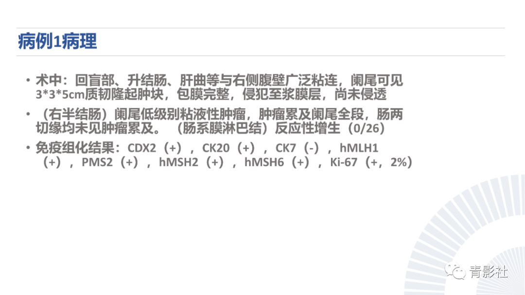 影像PPT - 【PPT】阑尾粘液性肿瘤的诊断-13
