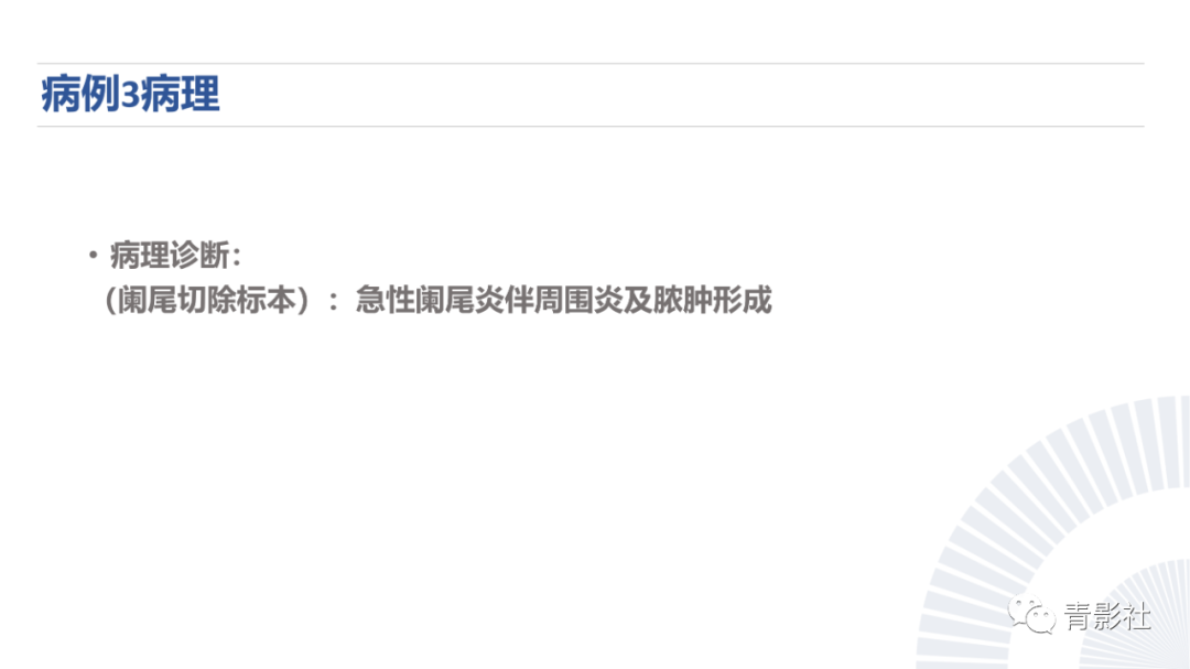 影像PPT - 【PPT】阑尾粘液性肿瘤的诊断-17