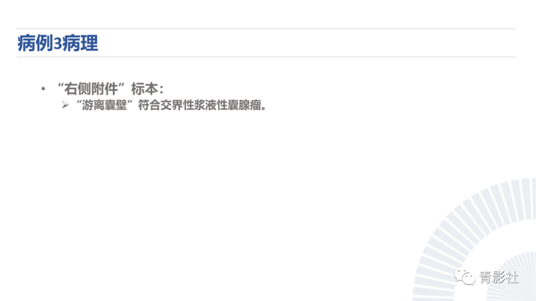 影像PPT - 【PPT】阑尾粘液性肿瘤的诊断-20