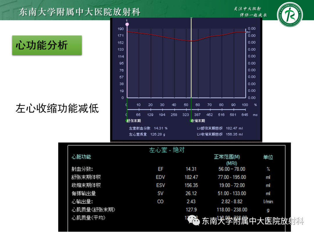 影像PPT - 【PPT】心脏结节病MR表现-3