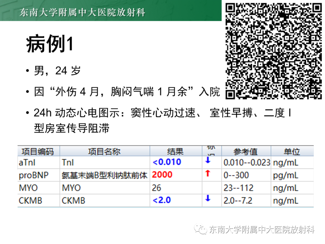 影像PPT - 【PPT】心脏结节病MR表现-1