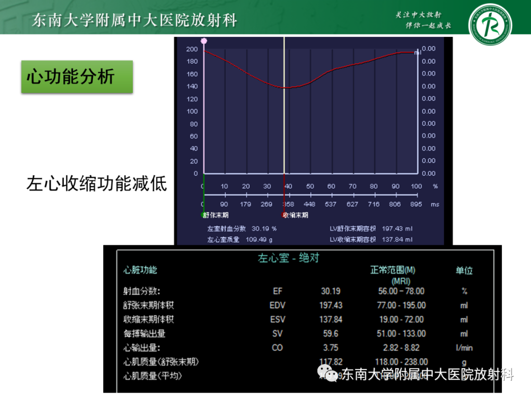 影像PPT - 【PPT】心脏结节病MR表现-13