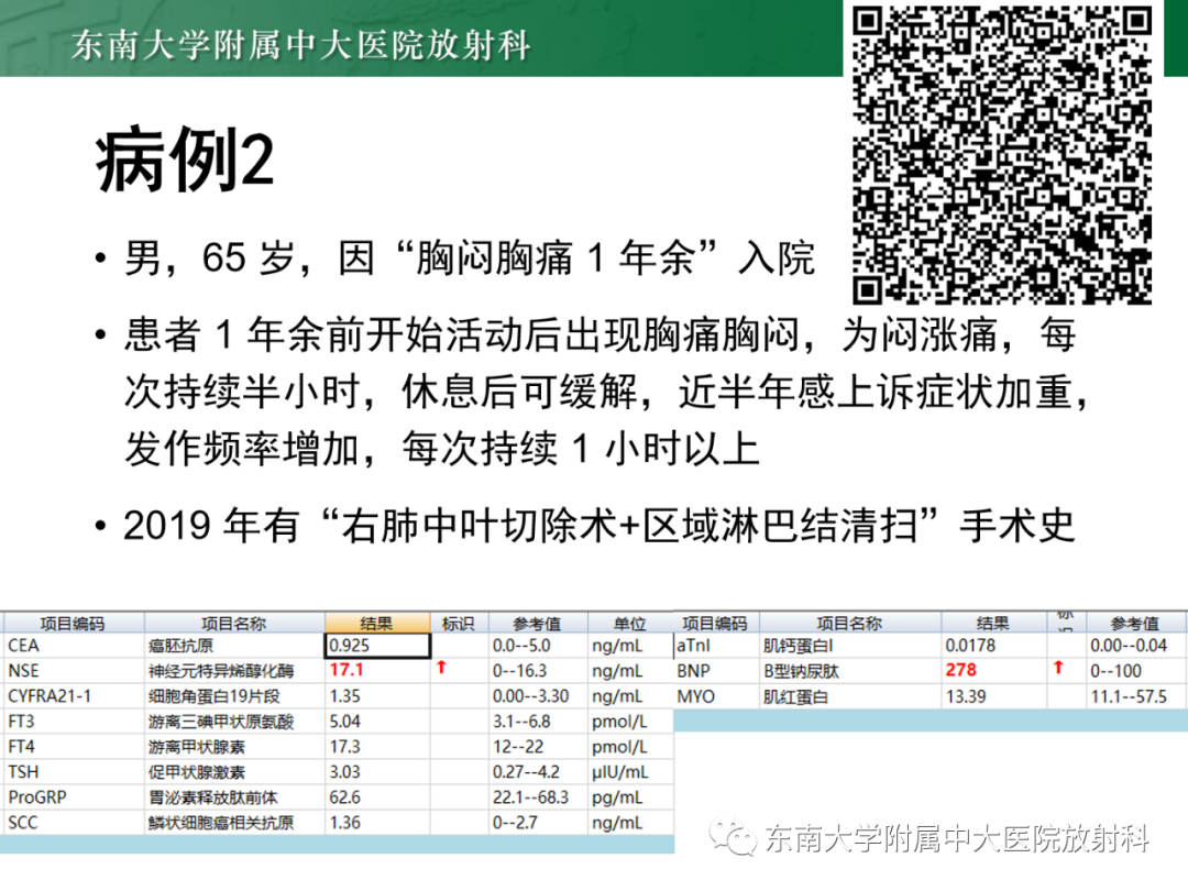 影像PPT - 【PPT】心脏结节病MR表现-18
